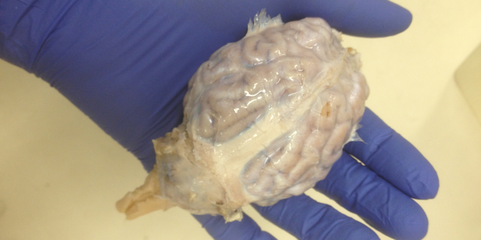 Sheep Brain